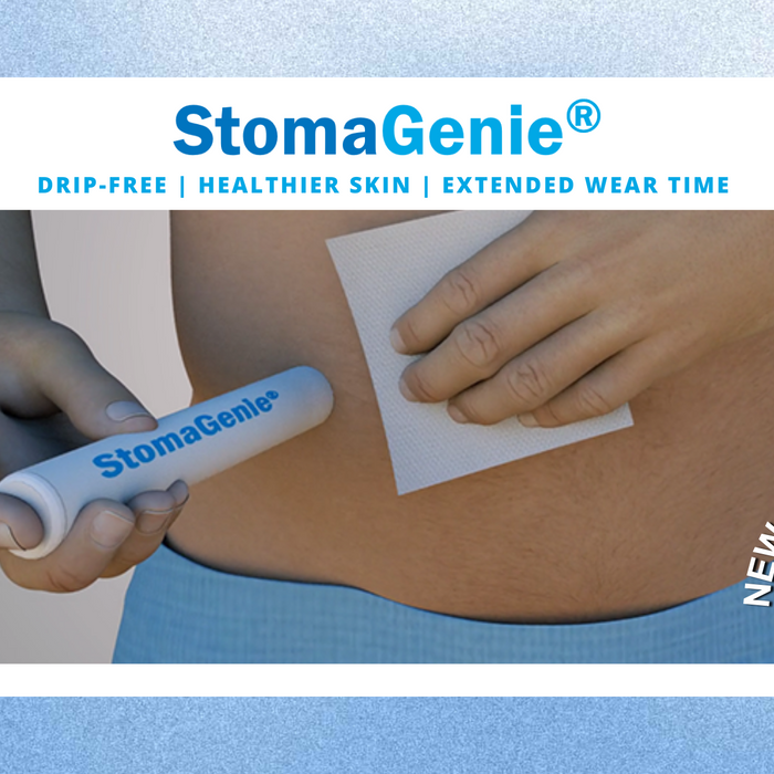 Introducing the StomaGenie: A better solution for ostomy changes