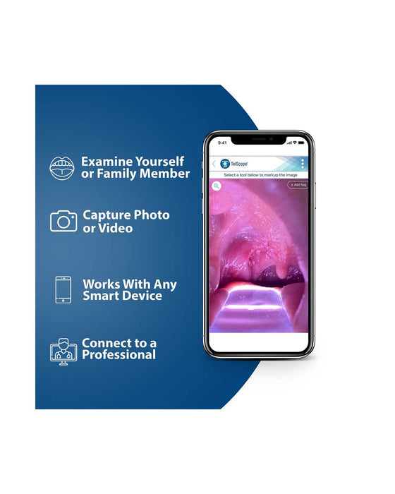 Throat Scope TelScope Telehealth System